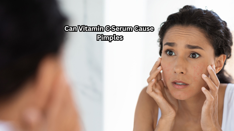 Can Vitamin C Serum Cause Pimples